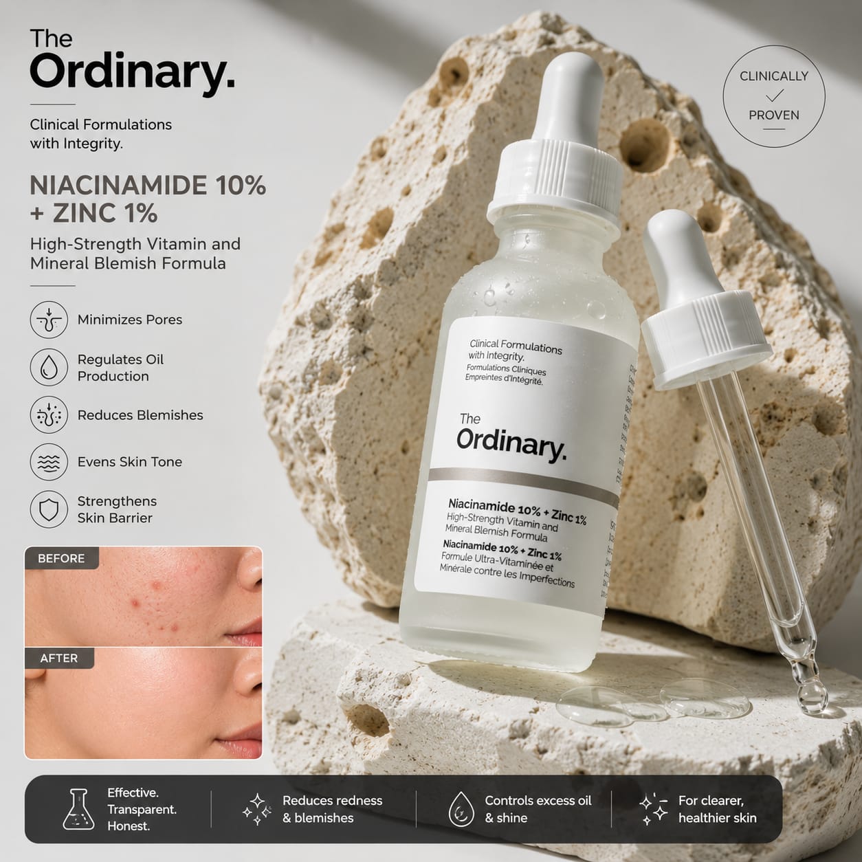 The Ordinary Niacinamide 10% + Zinc 1% Face Serum | Oil Control, Brightening & Pore Minimizing Skincare